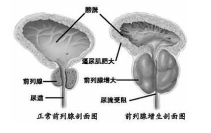 新乡医院哪家治疗男科比较好